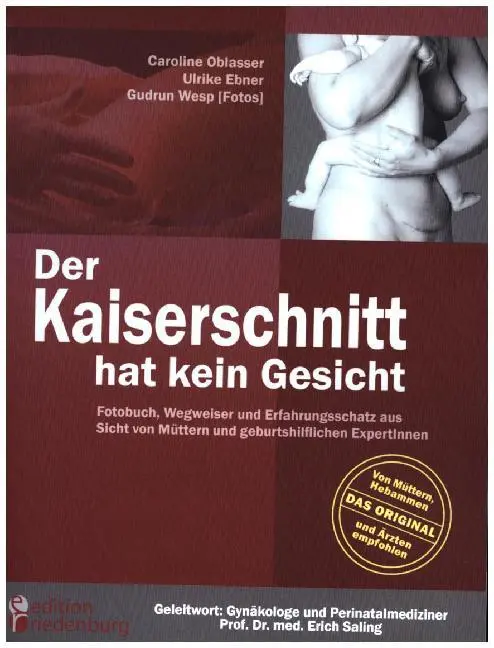 Cover: 9783950235708 | Der Kaiserschnitt hat kein Gesicht - Fotobuch, Wegweiser und...