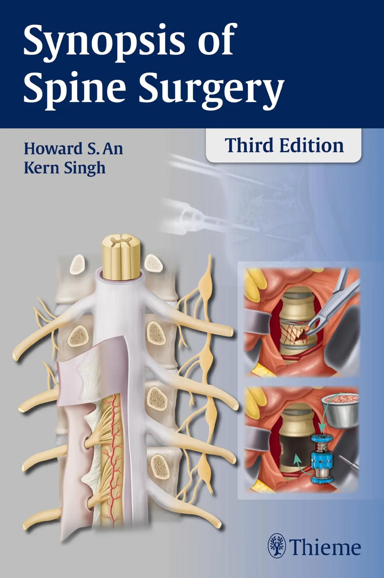 Cover: 9781626230309 | Synopsis of Spine Surgery | Howard S An (u. a.) | Taschenbuch | 334 S.