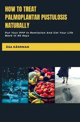 Cover: 9789151960609 | How To Treat Palmoplantar Pustulosis Naturally | Åsa Kärrman | Buch