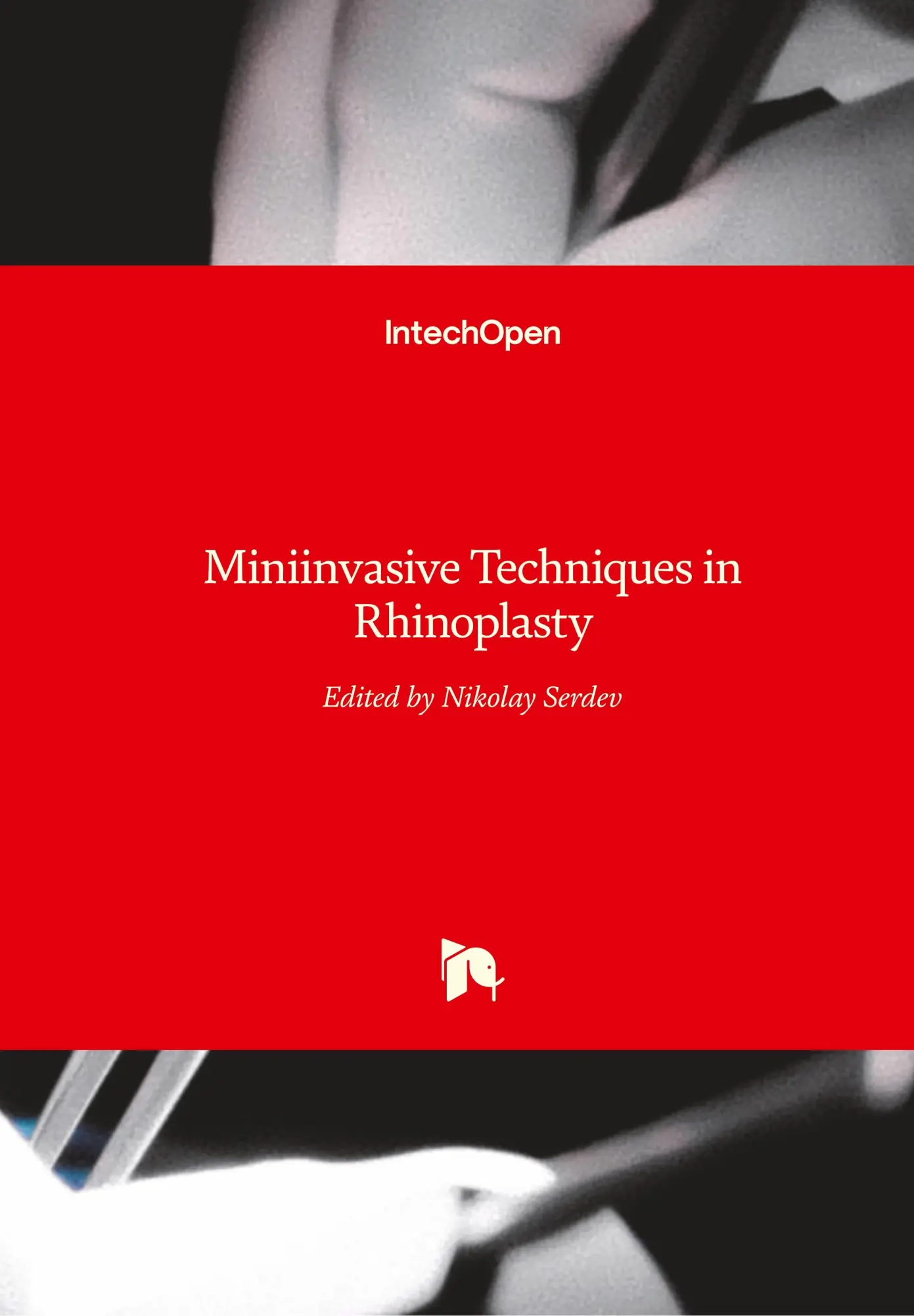 Cover: 9789535122609 | Miniinvasive Techniques in Rhinoplasty | Nikolay Serdev | Buch | 2016
