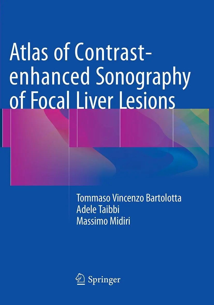 Cover: 9783319362809 | Atlas of Contrast-enhanced Sonography of Focal Liver Lesions | Buch