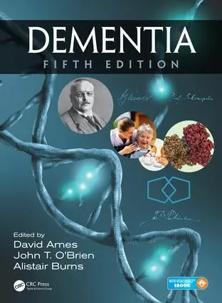 Cover: 9781498703109 | Dementia | David Ames (u. a.) | Buch | Englisch | 2017 | CRC Press
