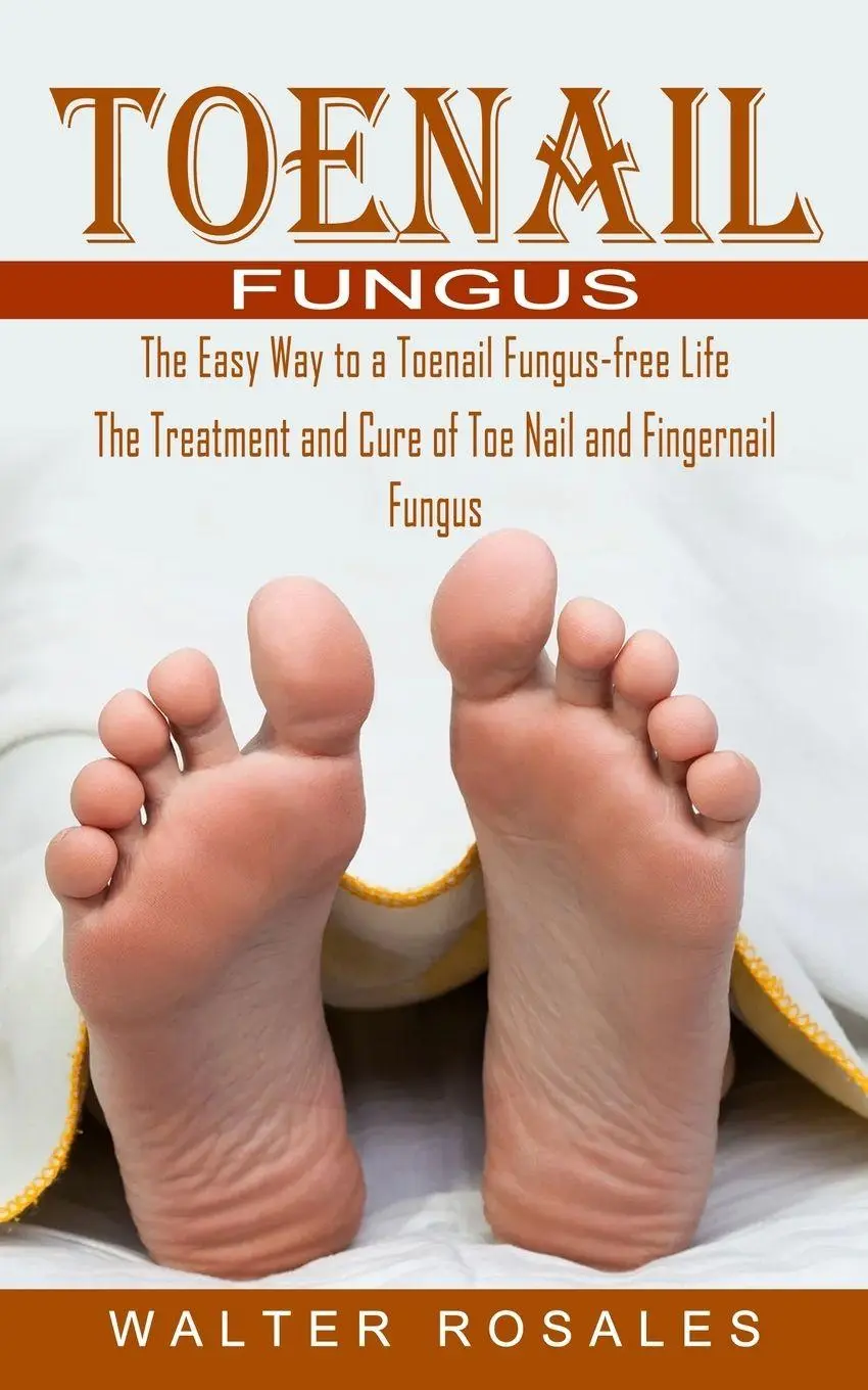 Cover: 9781774854709 | Toenail Fungus | Walter Rosales | Taschenbuch | Englisch | 2022
