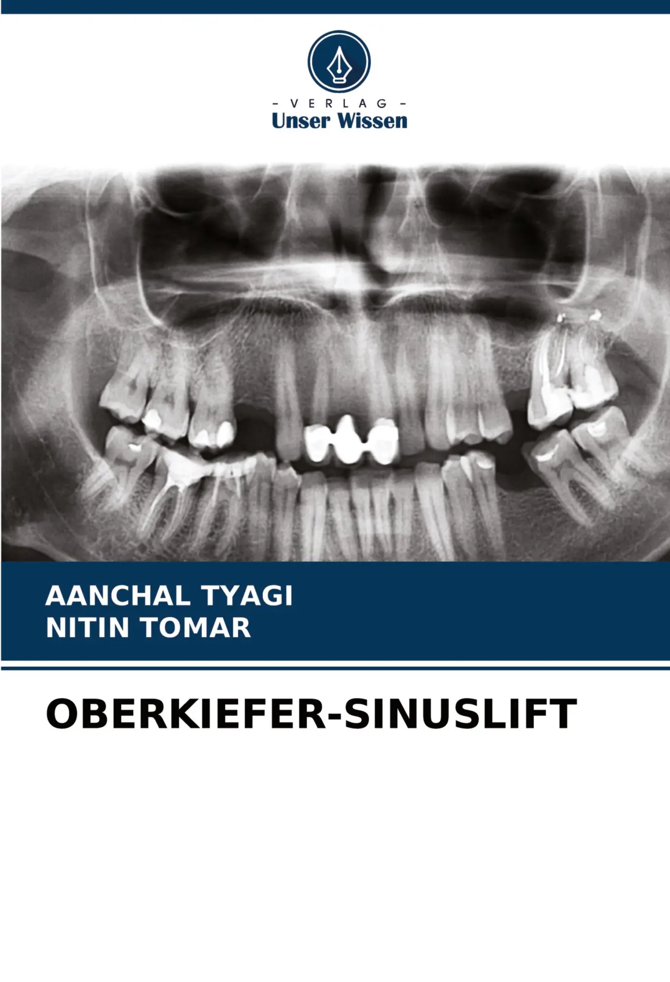 Cover: 9786204226309 | OBERKIEFER-SINUSLIFT | Aanchal Tyagi (u. a.) | Taschenbuch | 156 S.