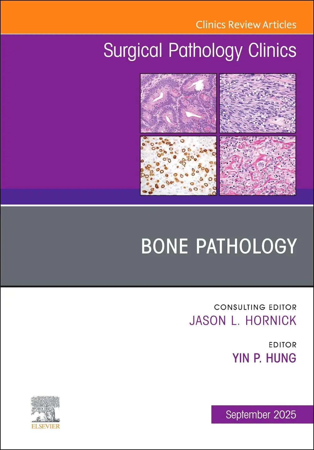 Cover: 9780443317309 | Bone Pathology, An Issue of Surgical Pathology Clinics | Yin P. Hung