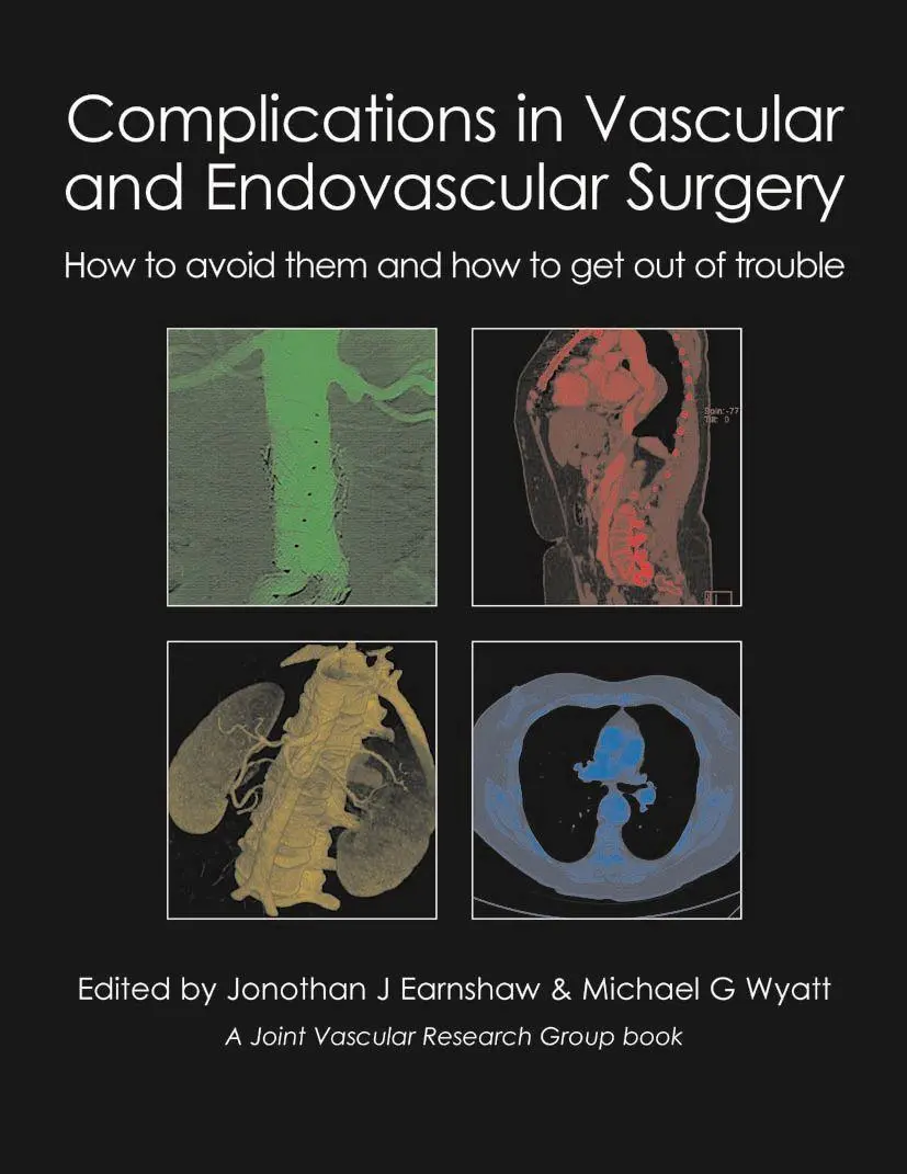 Cover: 9781903378809 | Complications in Vascular and Endovascular Surgery: How to Avoid...