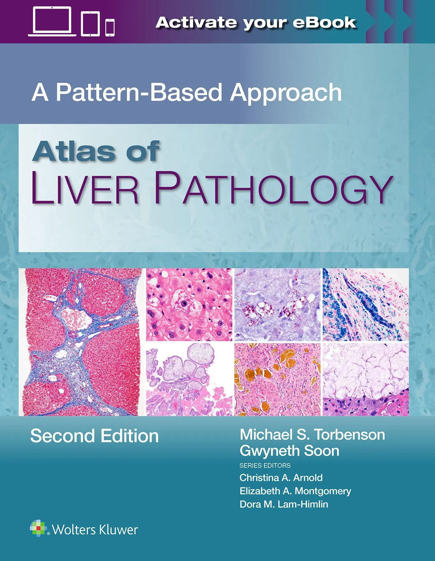 Cover: 9781975240110 | Atlas of Liver Pathology | A Pattern-Based Approach | Buch | Englisch