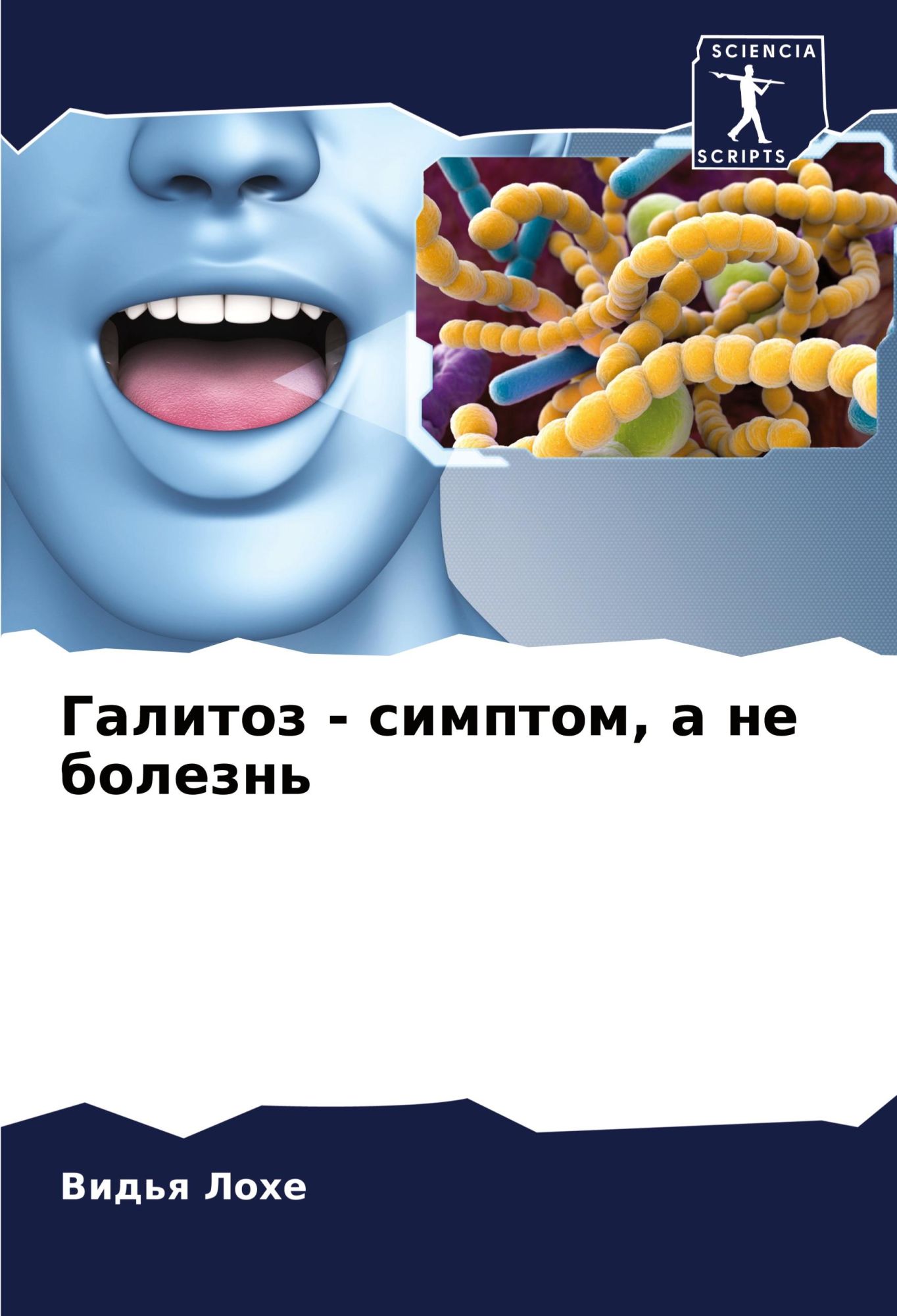 Cover: 9786204330310 | Galitoz - simptom, a ne bolezn' | Vid'q Lohe | Taschenbuch | Paperback