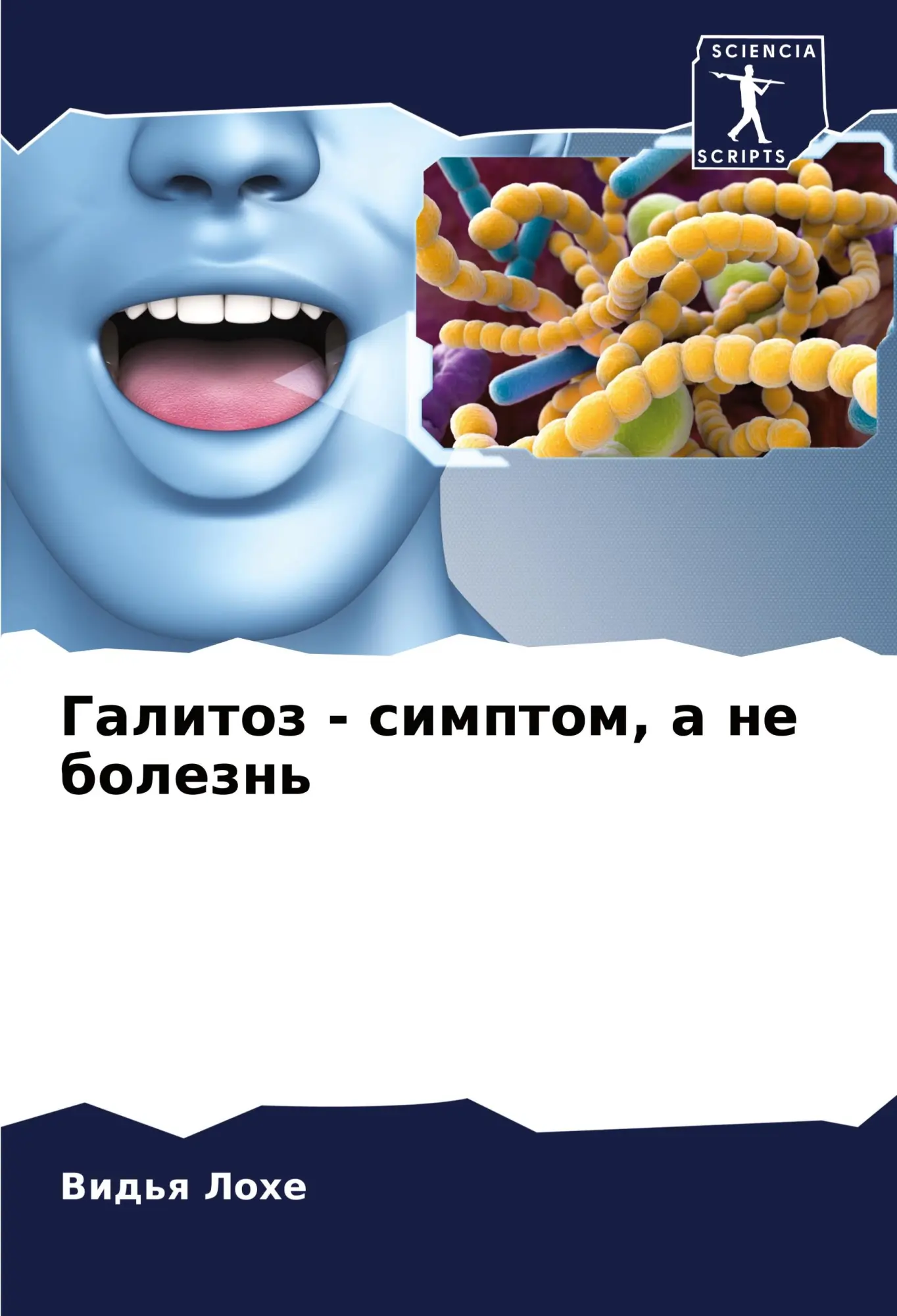 Cover: 9786204330310 | Galitoz - simptom, a ne bolezn' | Vid'q Lohe | Taschenbuch | Paperback