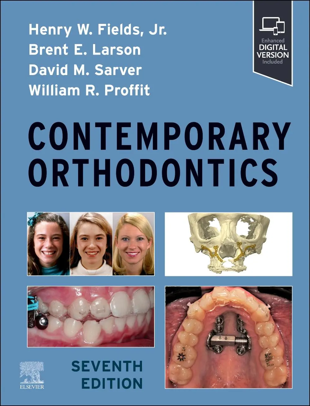 Cover: 9780323930710 | Contemporary Orthodontics | Brent Larson (u. a.) | Buch | Englisch