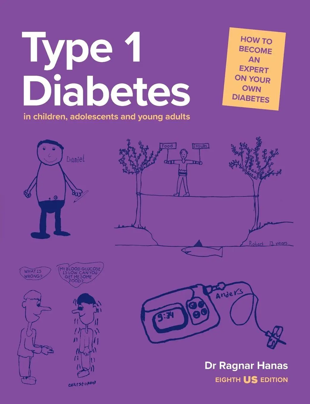 Cover: 9781801610810 | Type 1 Diabetes in Children, Adolescents and Young Adults | Hanas