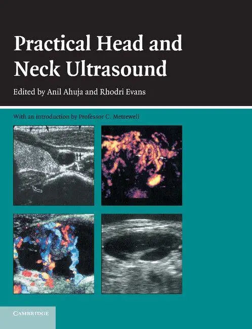 Cover: 9780521683210 | Practical Head &amp; Neck Ultrasound | Anil T. Ahuja (u. a.) | Taschenbuch