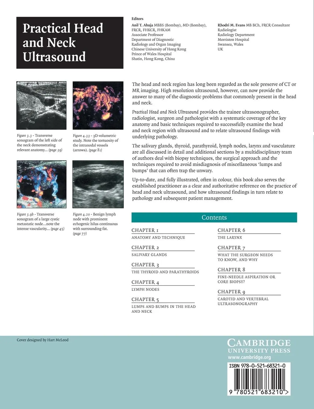 Rückseite: 9780521683210 | Practical Head &amp; Neck Ultrasound | Anil T. Ahuja (u. a.) | Taschenbuch