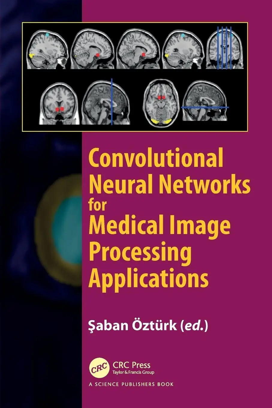 Cover: 9781032104010 | Convolutional Neural Networks for Medical Image Processing...