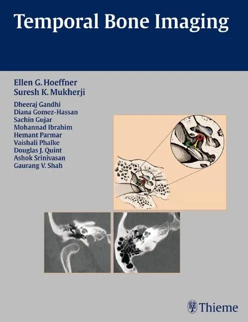 Cover: 9781588904010 | Temporal Bone Imaging | Ellen G Hoeffner (u. a.) | Buch | 244 S.