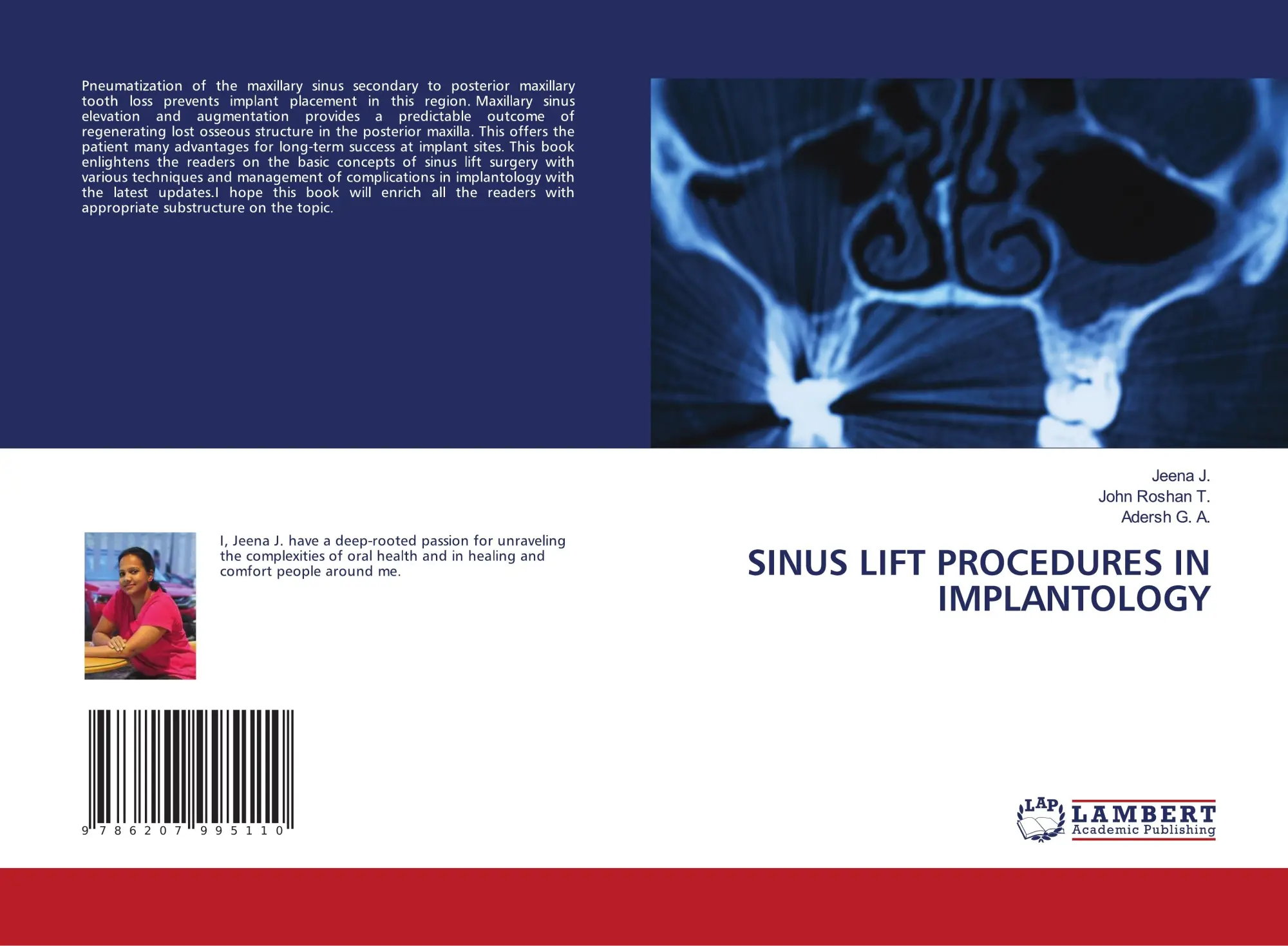 Cover: 9786207995110 | SINUS LIFT PROCEDURES IN IMPLANTOLOGY | Jeena J. (u. a.) | Taschenbuch
