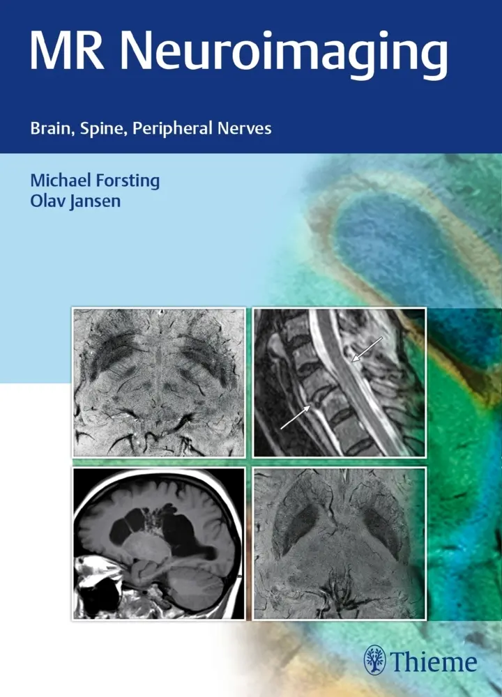 Cover: 9783132026810 | MR Neuroimaging | Brain, Spine, Peripheral Nerves | Forsting (u. a.)