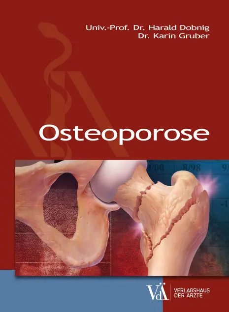 Cover: 9783990521311 | Osteoporose | Harald Dobnig (u. a.) | Taschenbuch | 168 S. | Deutsch