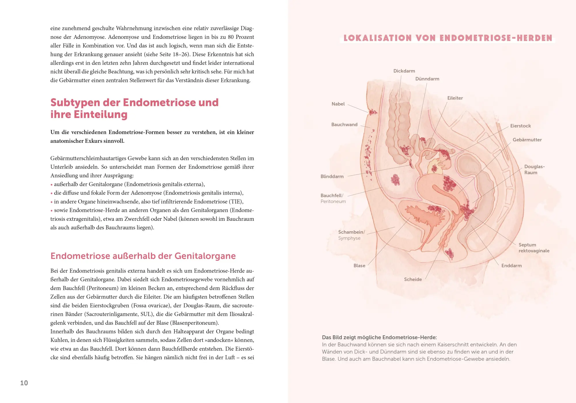 Bild: 9783965841611 | Endometriose - Die unterschätzte Krankheit | Sylvia Mechsner | Buch