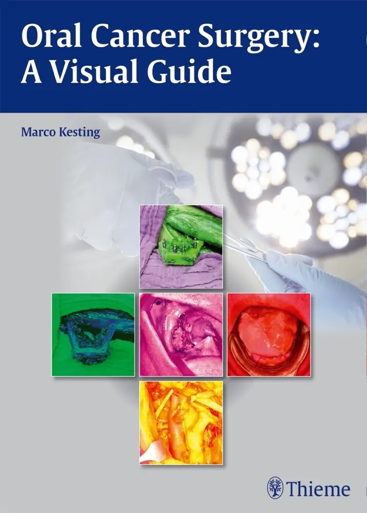 Cover: 9783131994011 | Oral Cancer Surgery | A Visual Guide | Marco Kesting | Buch | 132 S.