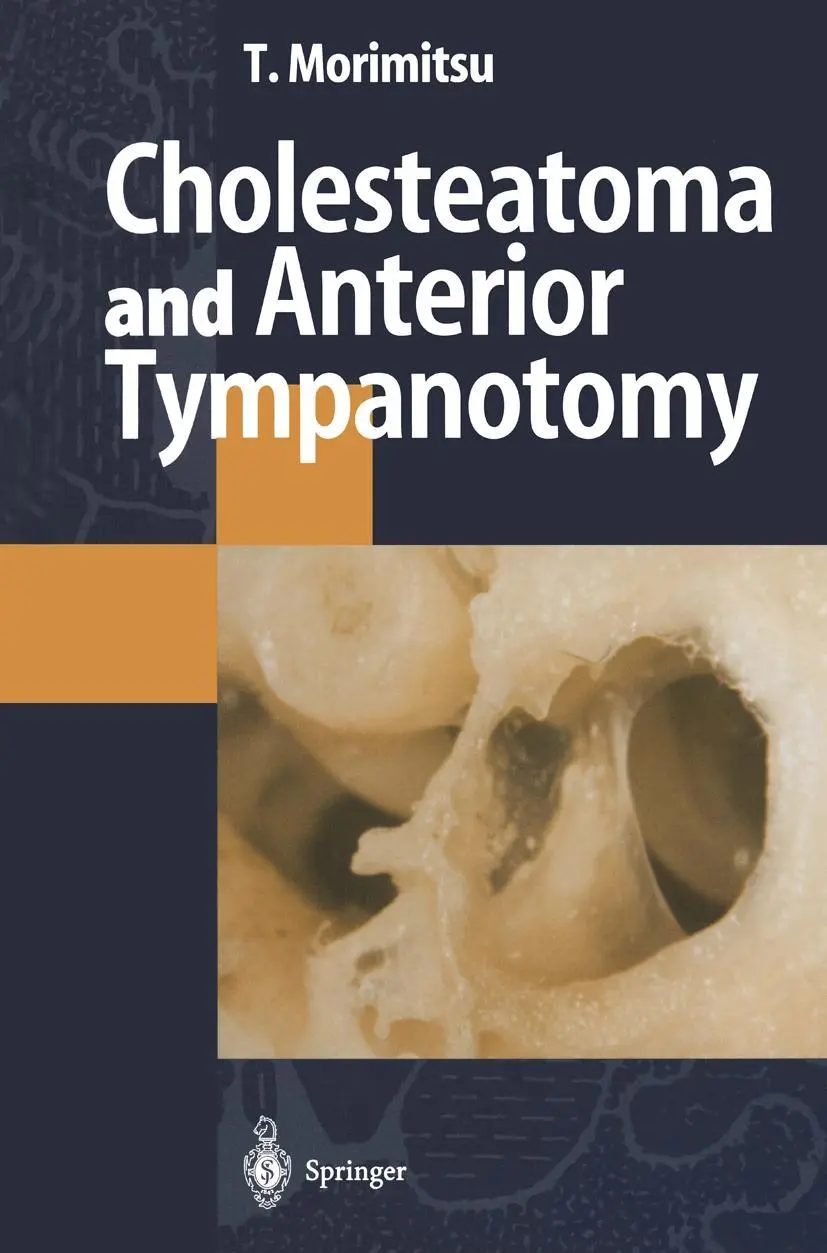 Cover: 9784431684411 | Cholesteatoma and Anterior Tympanotomy | Tamotsu Morimitsu | Buch