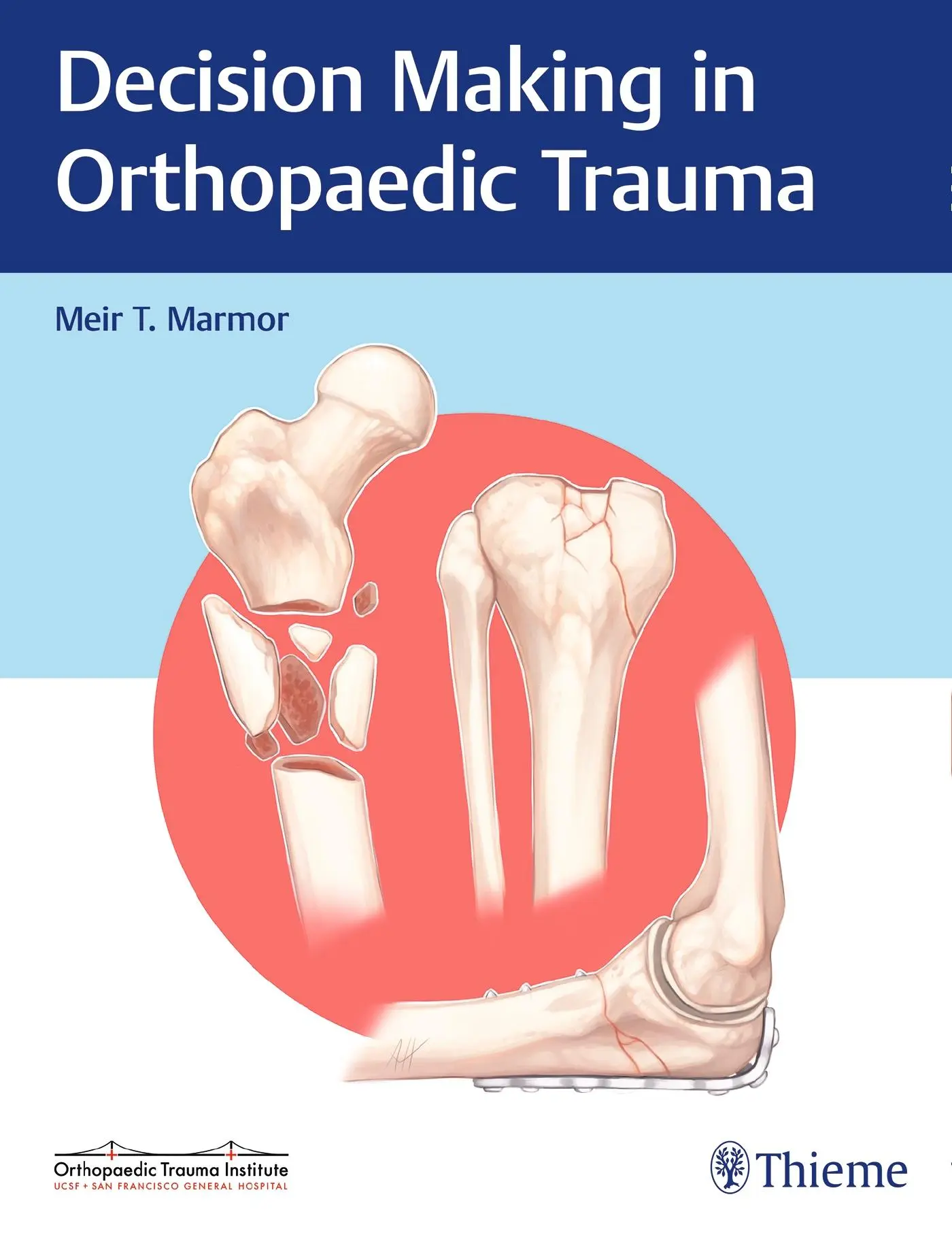 Cover: 9781626234611 | Decision Making in Orthopaedic Trauma | Meir Marmor | Buch | 190 S.