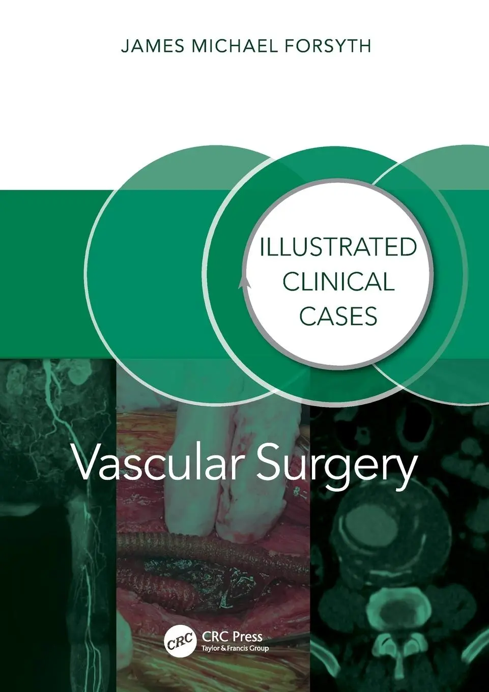 Cover: 9781032804811 | Vascular Surgery: | Illustrated Clinical Cases | James Forsyth | Buch