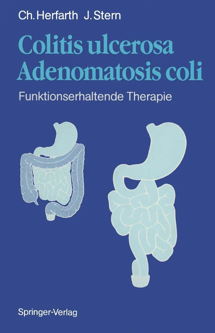 Cover: 9783642755811 | Colitis ulcerosa - Adenomatosis coli | Fünktionserhaltende Therapie