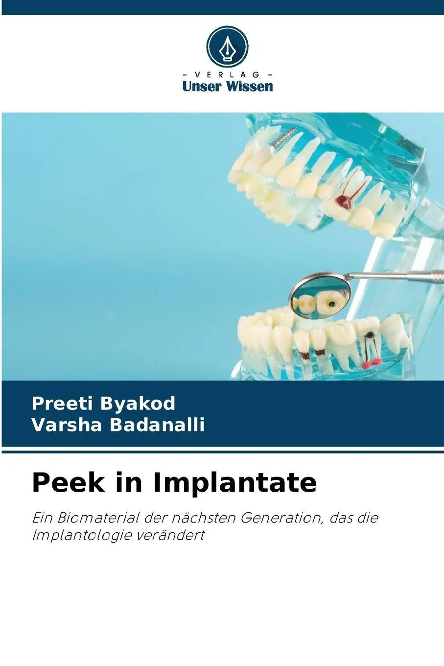 Cover: 9786209091612 | Peek in Implantate | Preeti Byakod (u. a.) | Taschenbuch | 108 S.