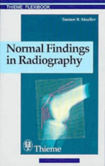 Cover: 9783131165312 | Normal Findings in Radiography | Torsten Bert Moeller | Taschenbuch