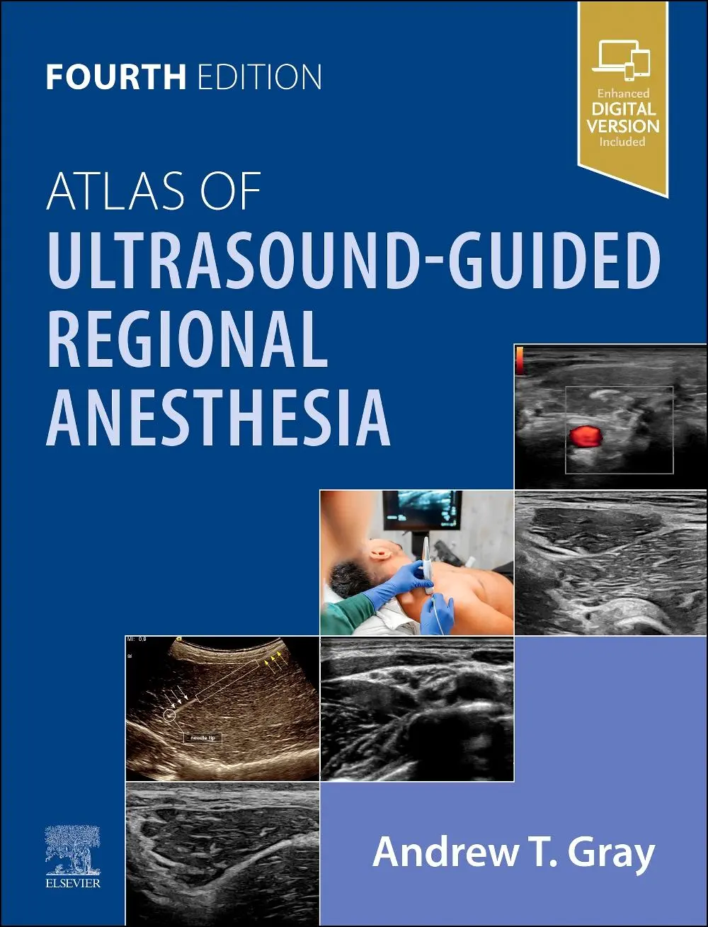 Cover: 9780443246012 | Atlas of Ultrasound-Guided Regional Anesthesia | Andrew T Gray | Buch