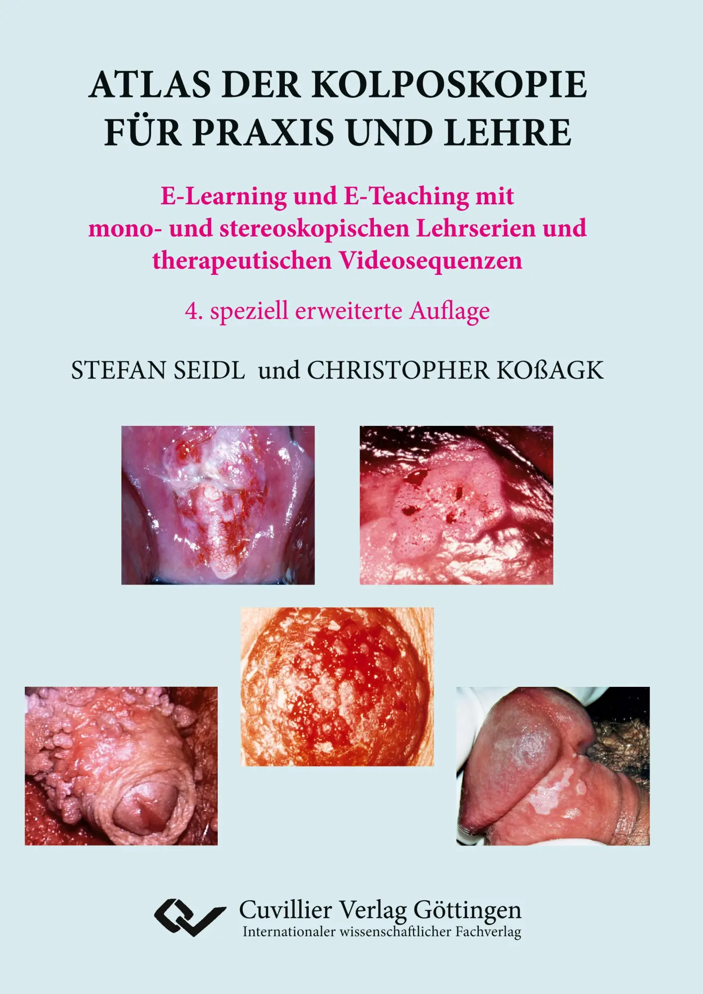 Cover: 9783736976412 | Atlas der Kolposkopie für Praxis und Lehre. E-Learning und...