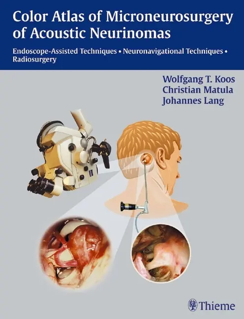 Cover: 9783131276612 | Color Atlas of Microneurosurgery of Acoustic Neurinomas | Koos | Buch