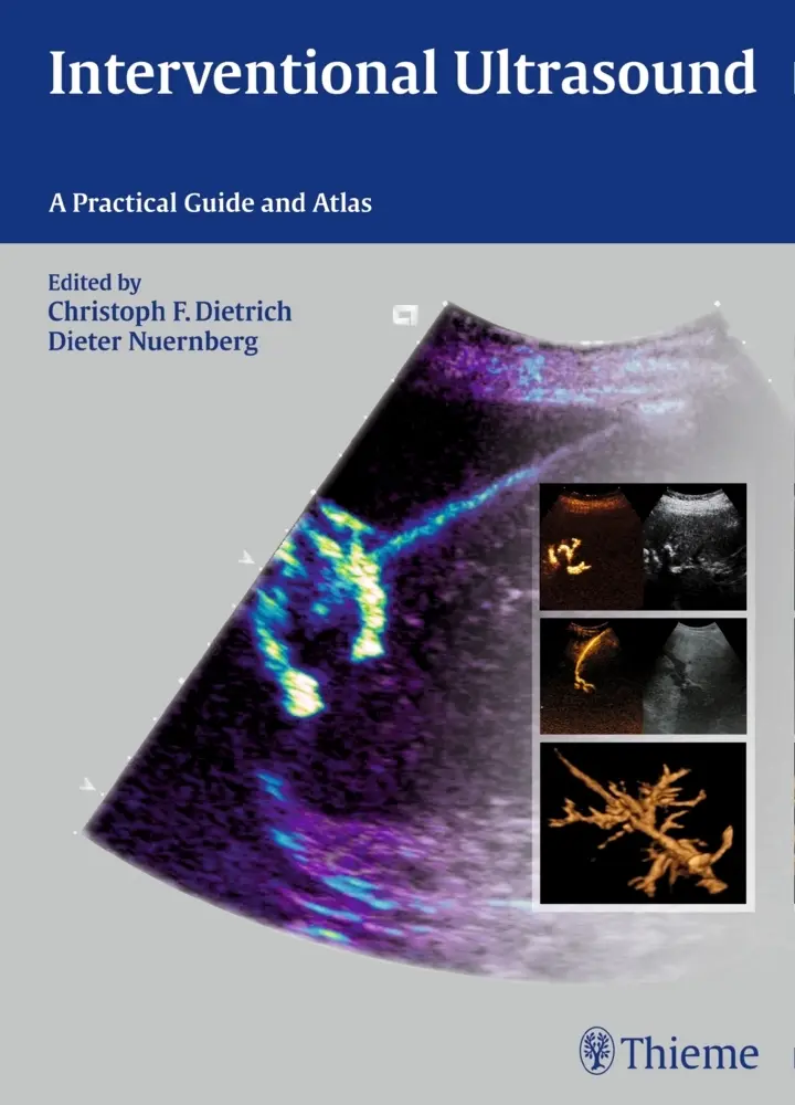 Cover: 9783131708212 | Interventional Ultrasound | A Practical Guide and Atlas | Buch | 2014