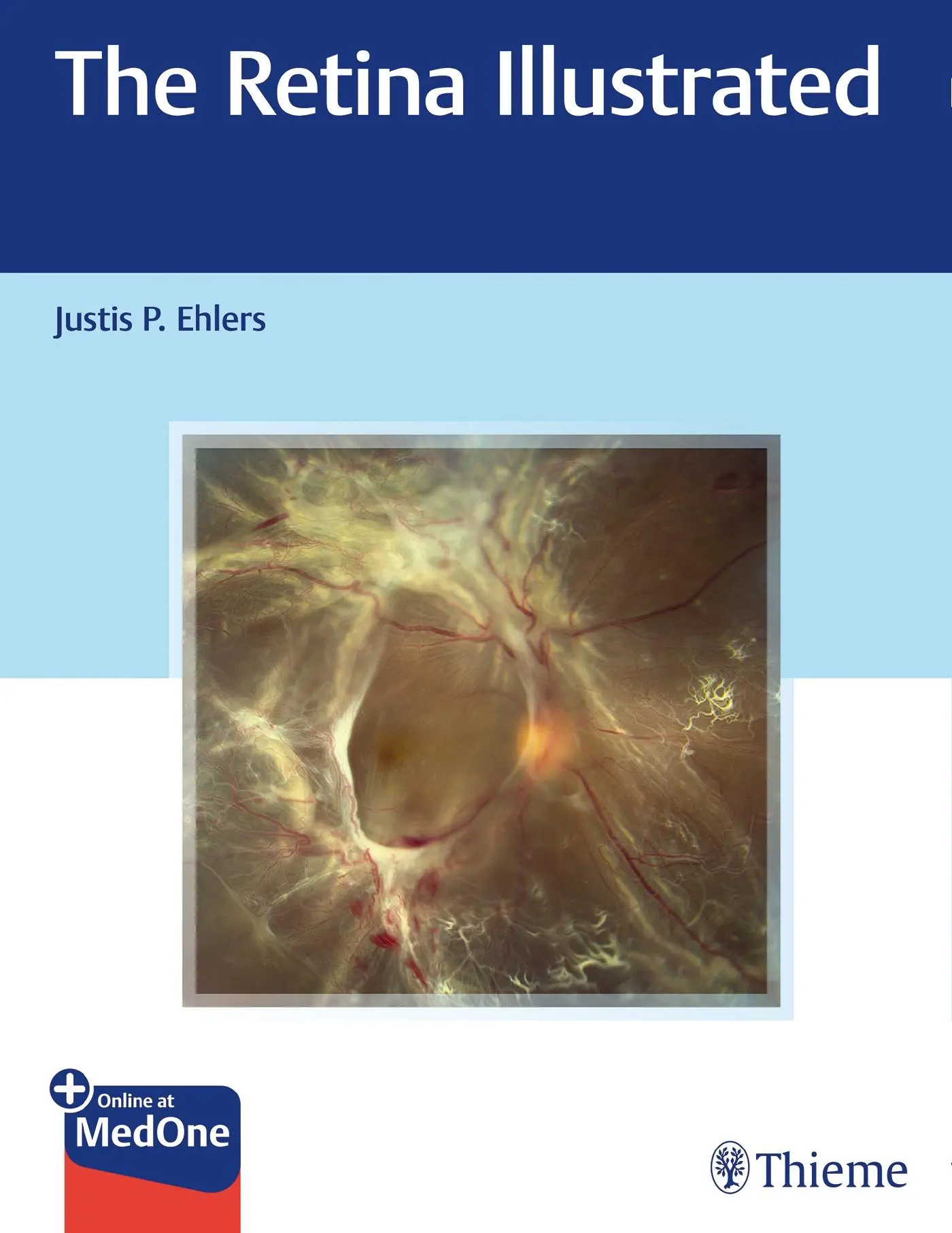 Cover: 9781626238312 | The Retina Illustrated | Justis P Ehlers | Taschenbuch | 1 eBook