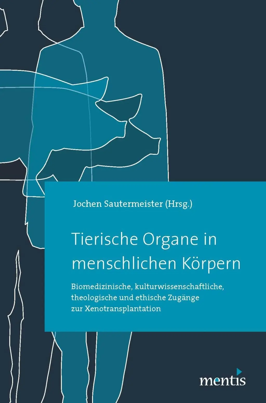 Cover: 9783957430113 | Tierische Organe in menschlichen Körpern | Jochen Sautermeister | Buch