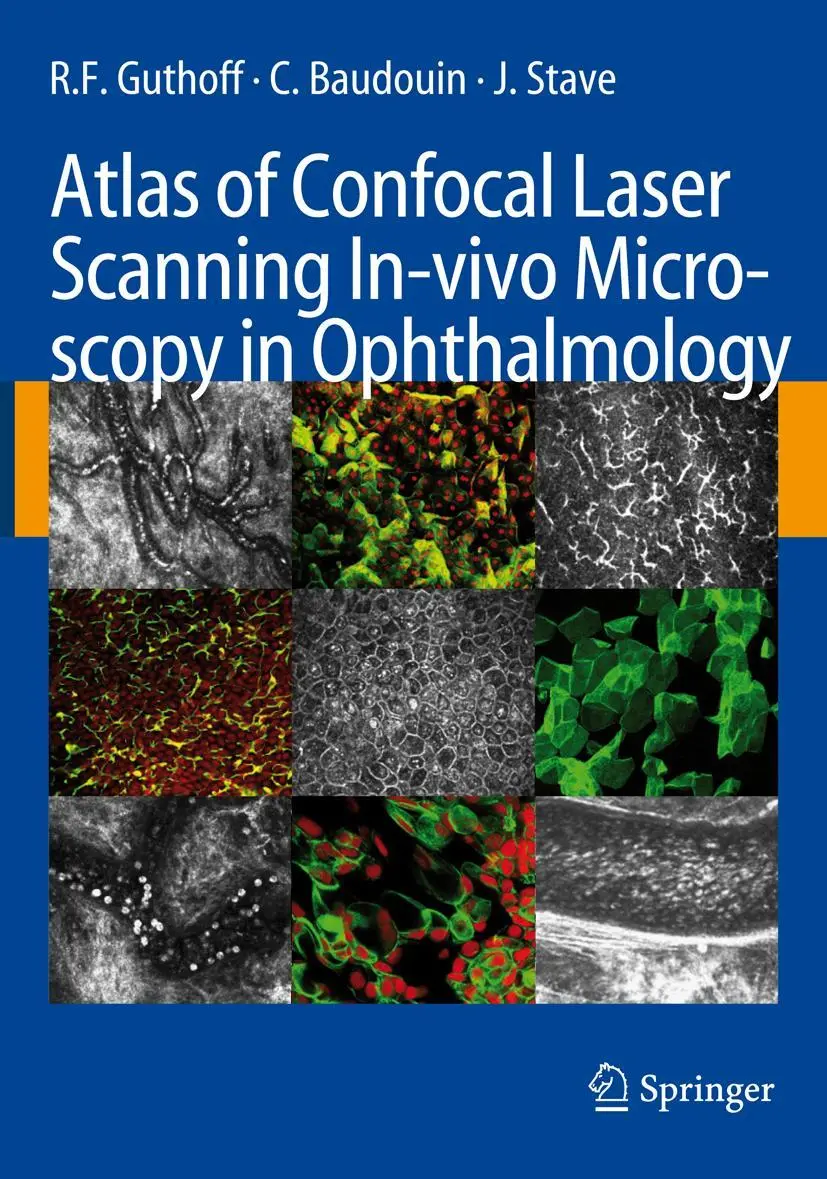 Cover: 9783662500613 | Atlas of Confocal Laser Scanning In-vivo Microscopy in Ophthalmology