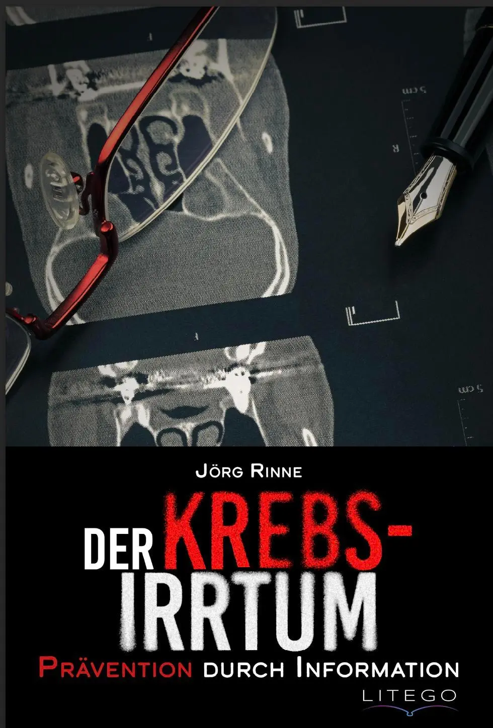 Cover: 9783991590613 | Der Krebs-Irrtum | Prävention durch Information | Jörg Rinne | Buch