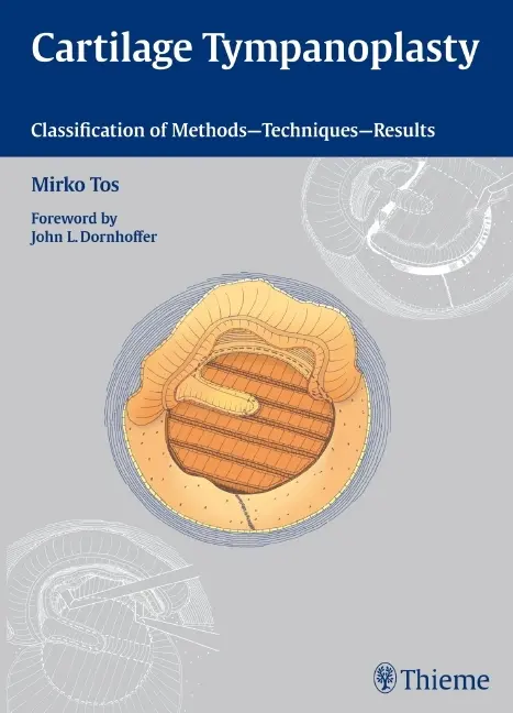 Cover: 9783131450913 | Cartilage Tympanoplasty | Mirko Tos | Taschenbuch | 448 S. | Englisch