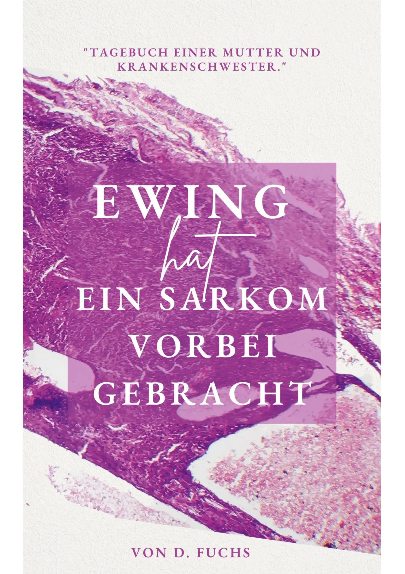 Cover: 9783757802813 | Ewing hat ein Sarkom vorbeigebracht | D. Fuchs | Taschenbuch | 148 S.