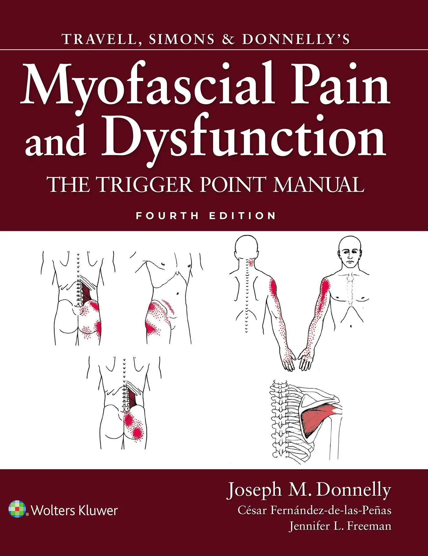 Cover: 9781975223113 | Travell, Simons &amp; Donnelly's Myofascial Pain and Dysfunction | Buch