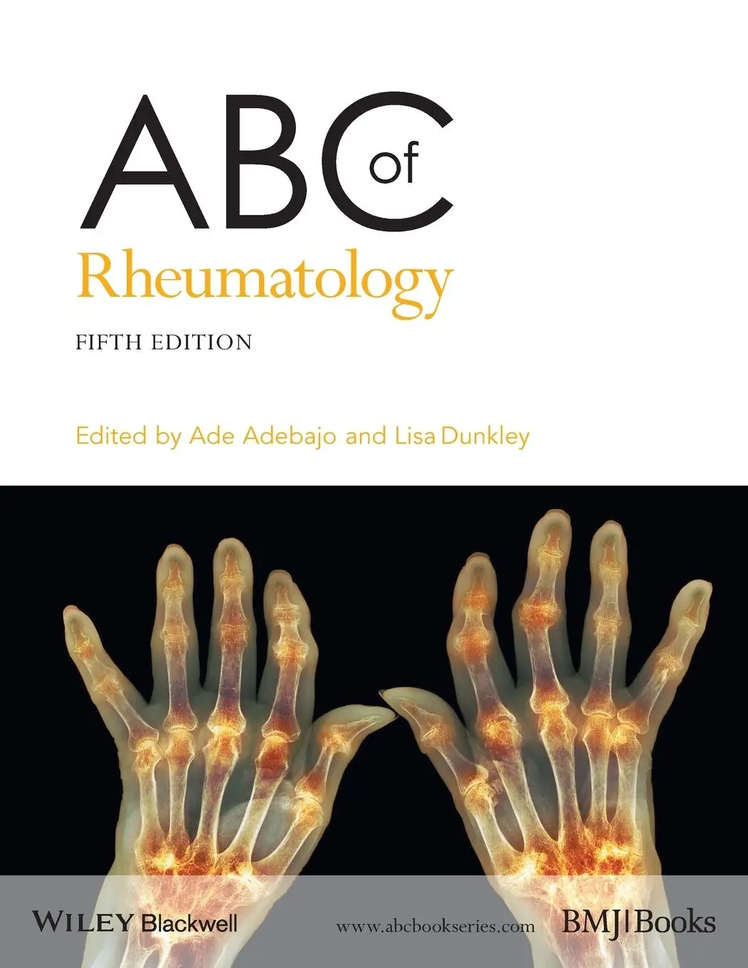 Cover: 9781118793213 | ABC of Rheumatology | Ade Adebajo (u. a.) | Taschenbuch | 224 S.