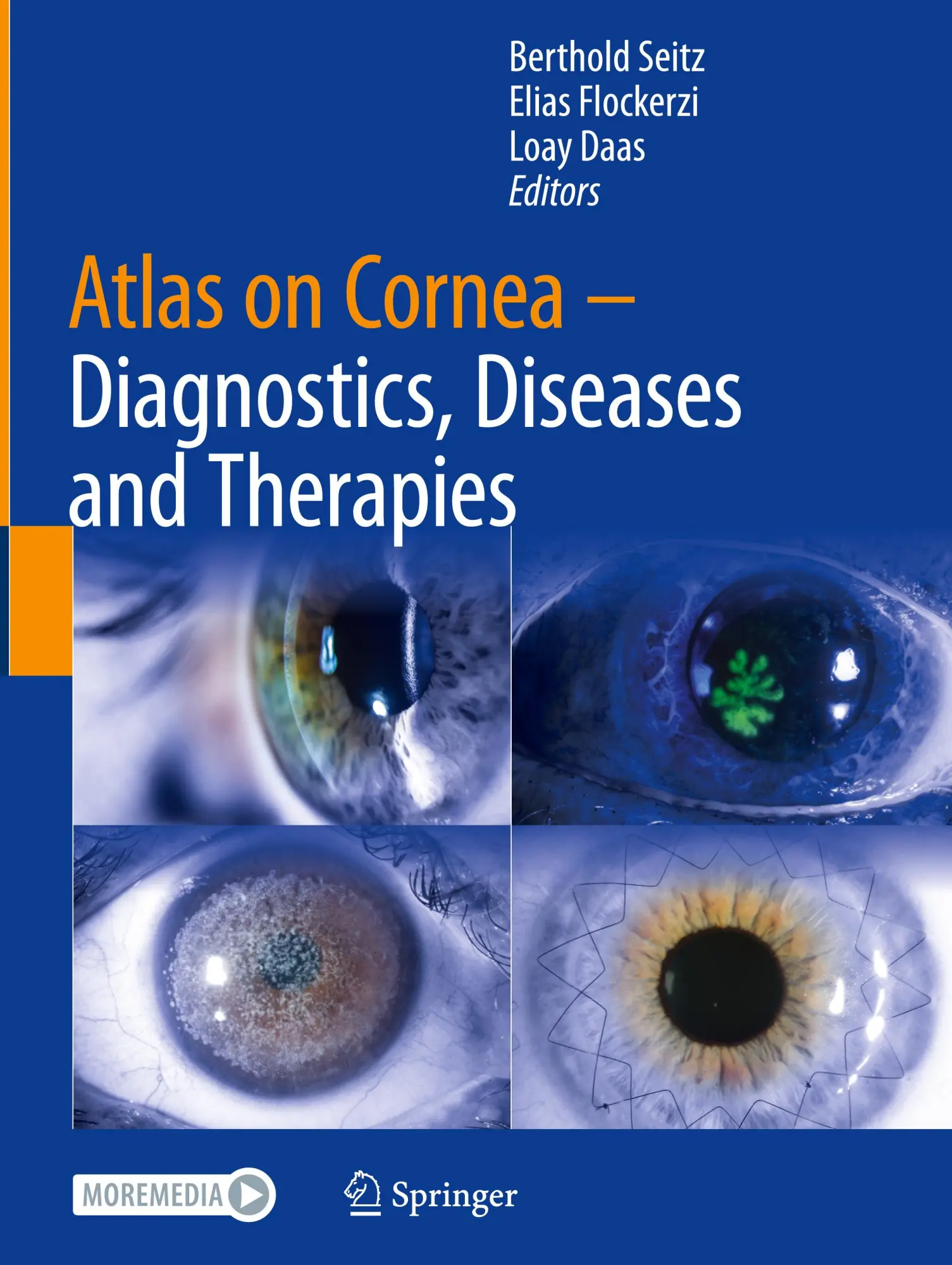 Cover: 9783031654213 | Atlas on Cornea | Diagnostics, Diseases and Therapies | Seitz (u. a.)