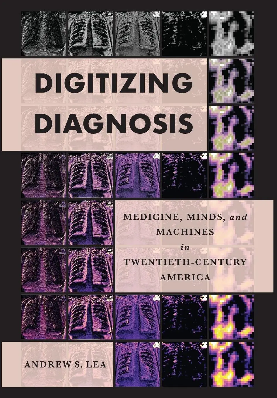 Cover: 9781421446813 | Digitizing Diagnosis | Andrew S. Lea | Buch | Gebunden | Englisch