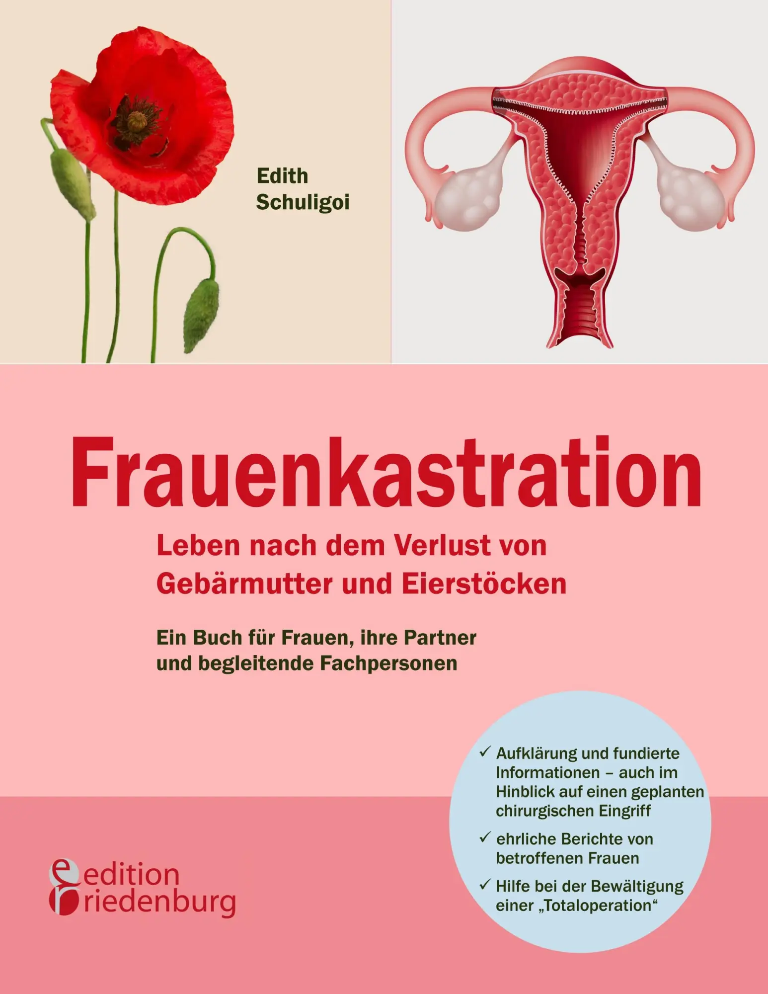 Cover: 9783902647313 | Frauenkastration - Leben nach dem Verlust von Gebärmutter und...