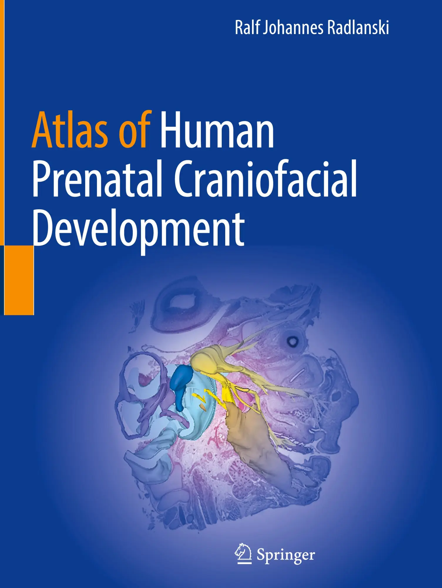 Cover: 9783031888113 | Atlas of Human Prenatal Craniofacial Development | Radlanski | Buch