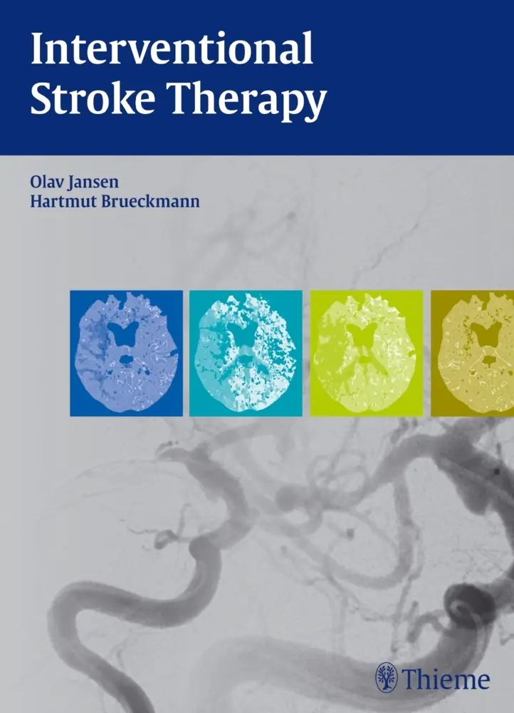 Cover: 9783131699213 | Interventional Stroke Therapy | Olav Jansen (u. a.) | Buch | 224 S.