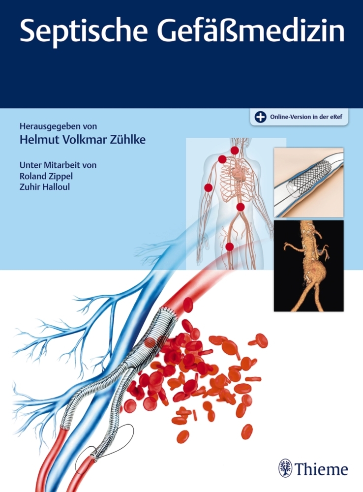 Cover: 9783132009813 | Septische Gefäßmedizin | Helmut V. Zühlke | Bundle | Deutsch | 2019