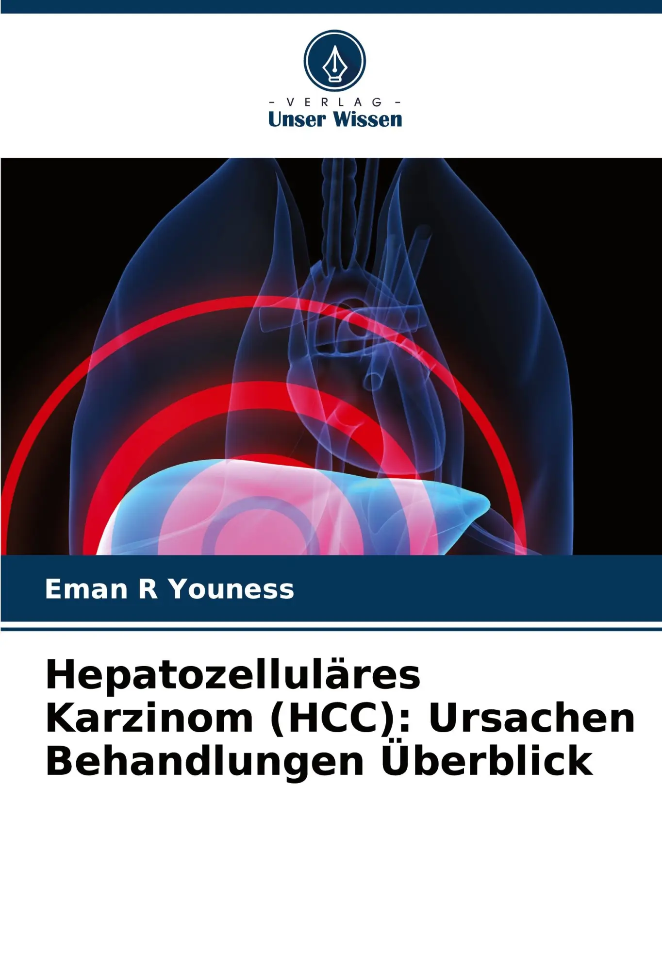 Cover: 9786208341114 | Hepatozelluläres Karzinom (HCC): Ursachen Behandlungen Überblick