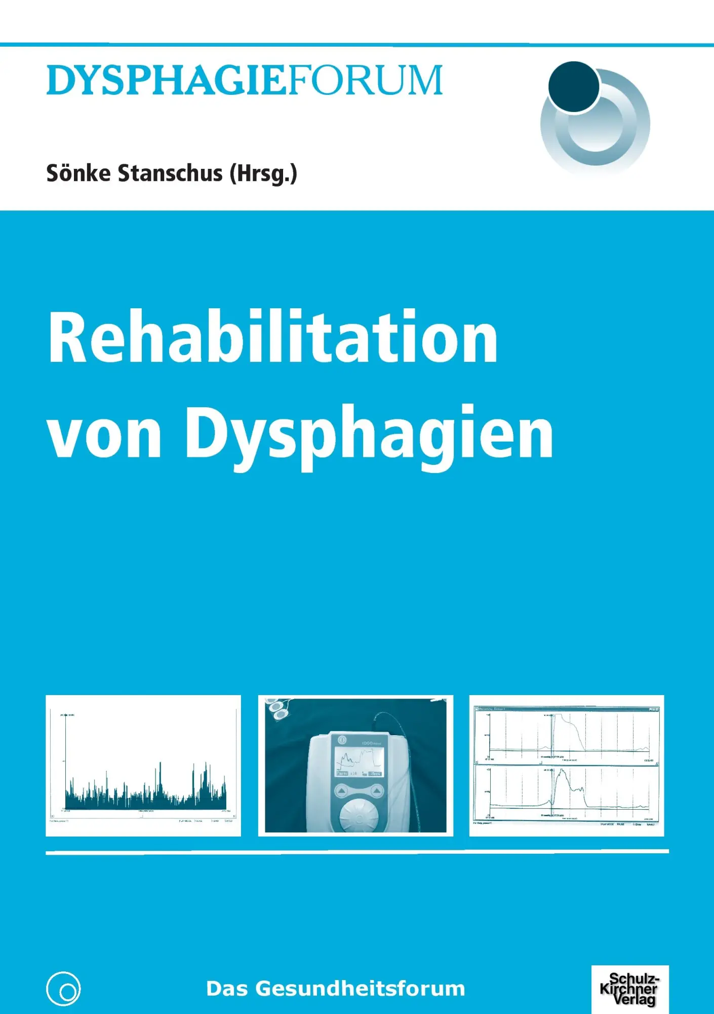 Cover: 9783824803514 | Rehabilitation von Dysphagien | Sönke Stanschus | Taschenbuch | 2014